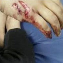 موجة غبار تجتاح جازان .. وانخفاض في مستوى الرؤية