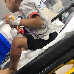 استجابة للأهالي..”بلدي العارضة” يوصي بزيادة إنارة حديقة الملك بالرخ