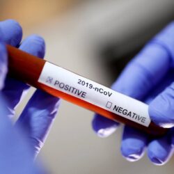 “الصحة”: تسجيل 55 حالة إصابة بكورونا.. وتعافي 52 خلال الـ24 ساعة الماضية