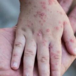 الأرصاد تتوقع تقلبات جوية في ثلاث مناطق.. رياح نشطة وأتربة مثارة