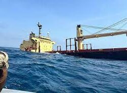 الدكتور الربيعة يطمئن على صحة التوأم السيامي العراقي (عمر وعلي) بعد عدة أشهر من فصلهما