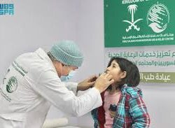 حالة الطقس المتوقعة اليوم