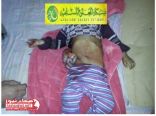 الحوثيون يقتلون طفلا في عامه الثاني بطلقة رشاش ثقيل مزقت أحشاءه في دماج