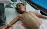 صاروخ حوثي يتسبب بوفاة طفل يمني ويصيب 5 آخرين